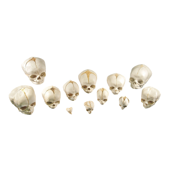 Replica Human Fetal Skulls - Set of 12