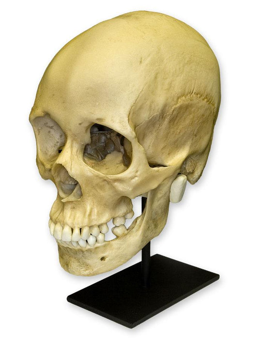 Replica Human Female with Multiple Gunshot Wounds Skull