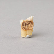 Real Human Tooth with Decay - Single