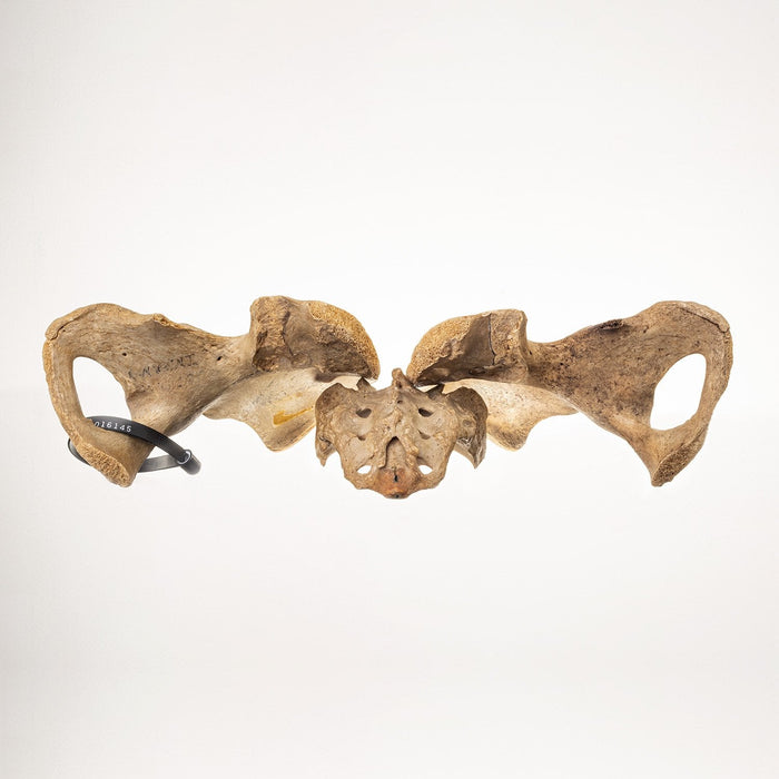 Real Human Pelvis and Sacrum - Antique