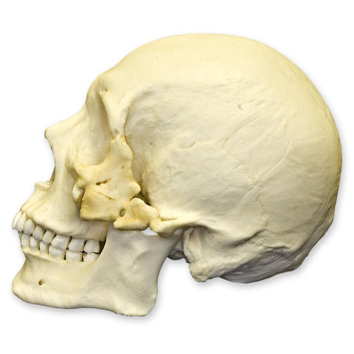 Replica Human Healed Trauma Skull