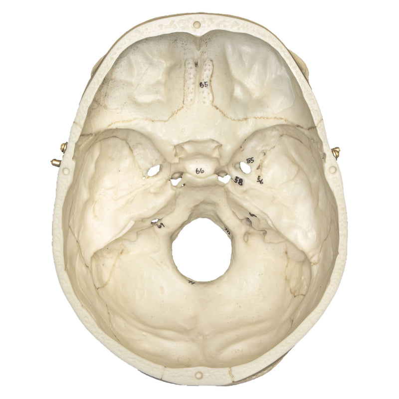 Replica Human European Male Skull - Calvarium Cut and Numbered