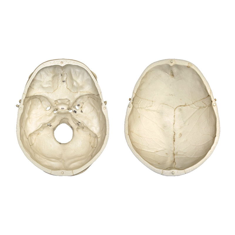 Replica Human European Male Skull - Calvarium Cut and Numbered