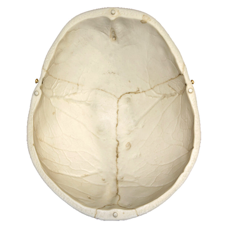 Replica Human European Male Skull - Calvarium Cut and Numbered