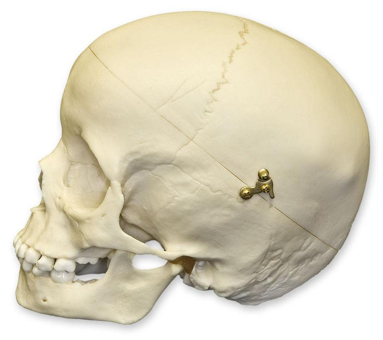 Replica 5-year-old Human Child Skull Calvarium Cut