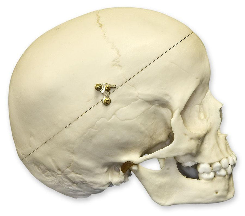 Replica 5-year-old Human Child Skull Calvarium Cut