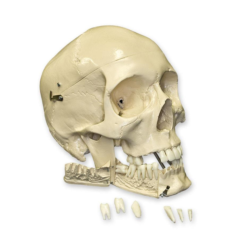 Replica Human Skull with Teeth for Extraction 4 Part