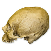 Replica Human Skull - Trephined