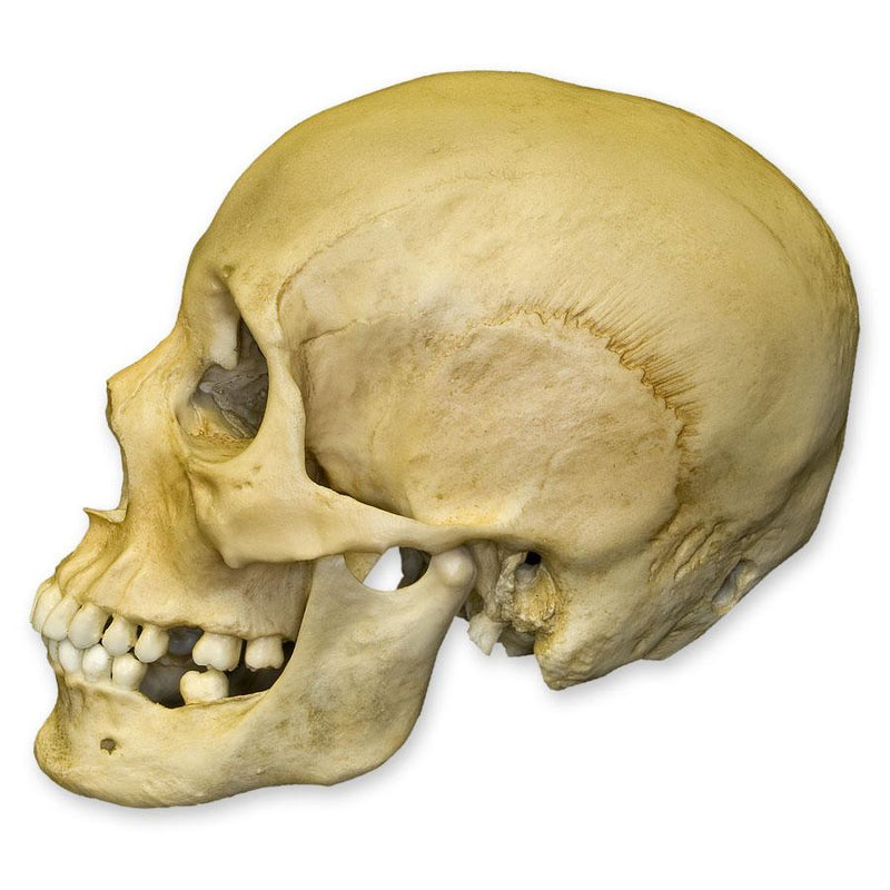 Replica Human Female with Multiple Gunshot Wounds Skull