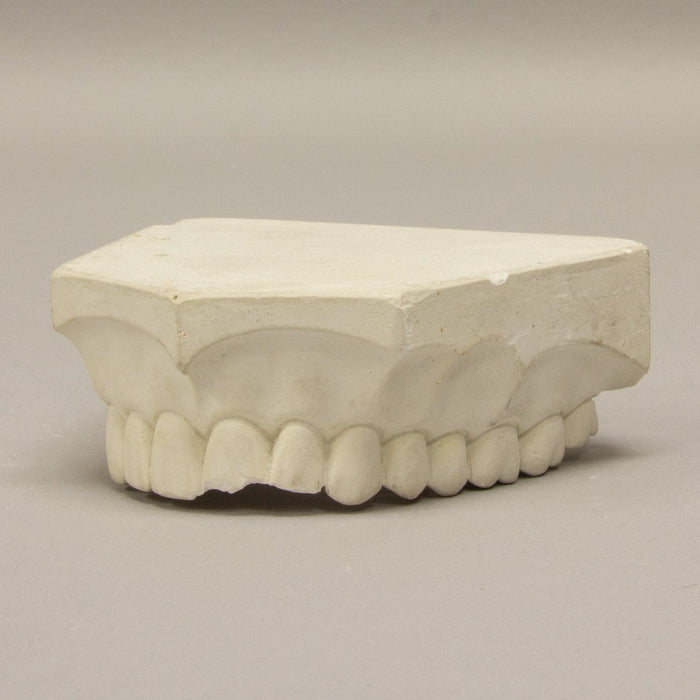 Replica Orthodontic Study Model
