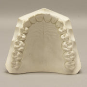 Replica Orthodontic Study Model