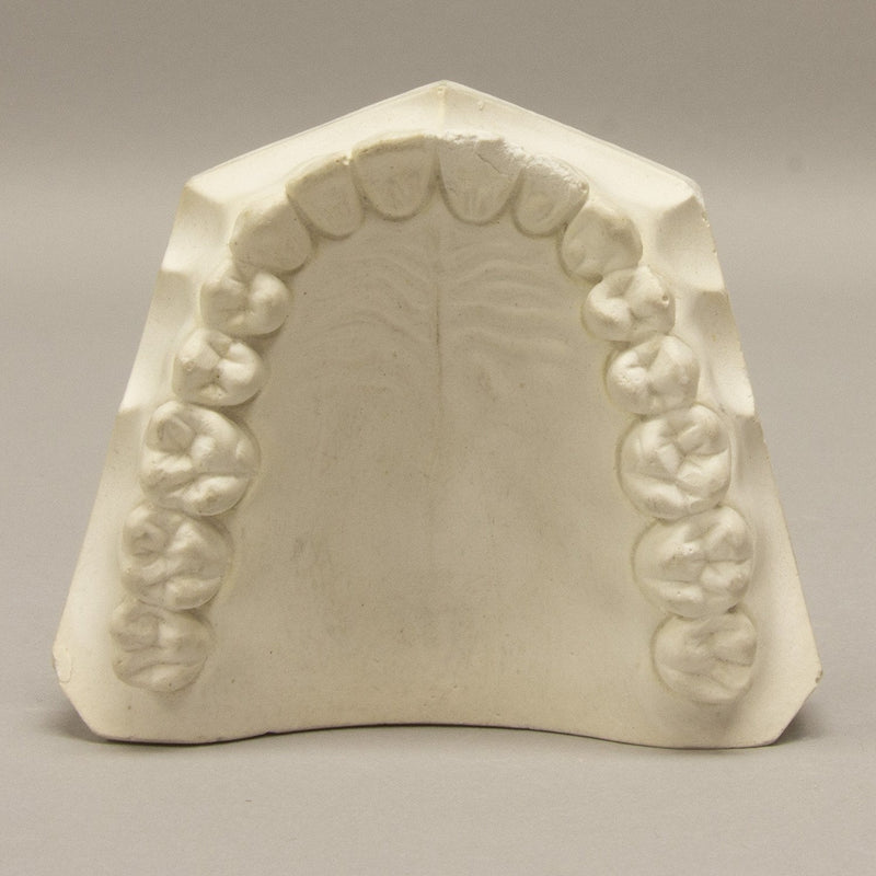Replica Orthodontic Study Model