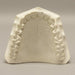 Replica Orthodontic Study Model
