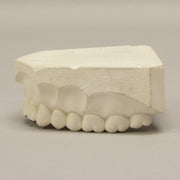 Replica Orthodontic Study Model