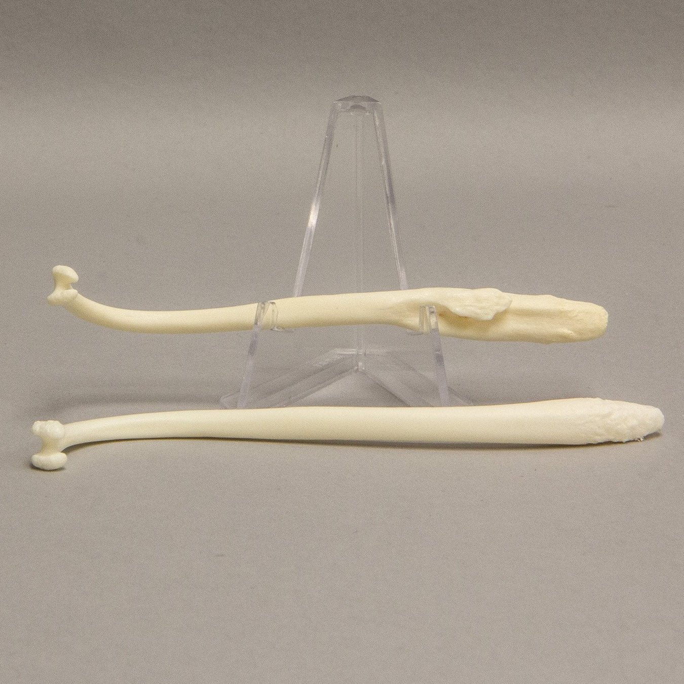 Bone Disease Specimens