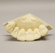 Replica Orthodontic Study Model