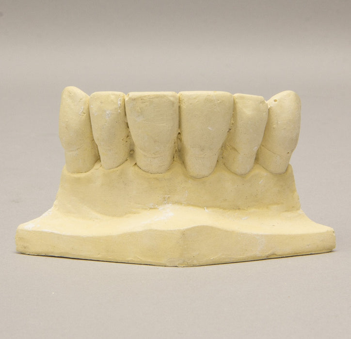 Replica Orthodontic Study Model