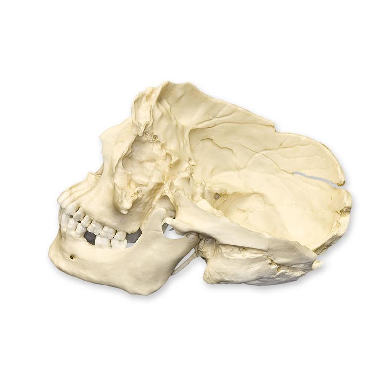 Replica Human Male with Machete Wounds Skull