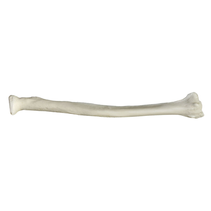 Replica Human Radius