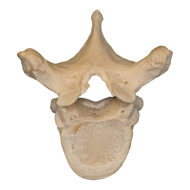 Real Human Thoracic Vertebra - Single