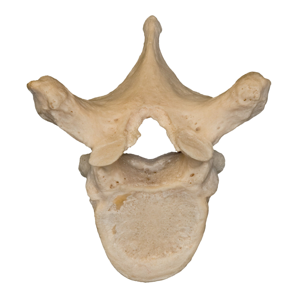 Real Humans Real Human Vertebrae