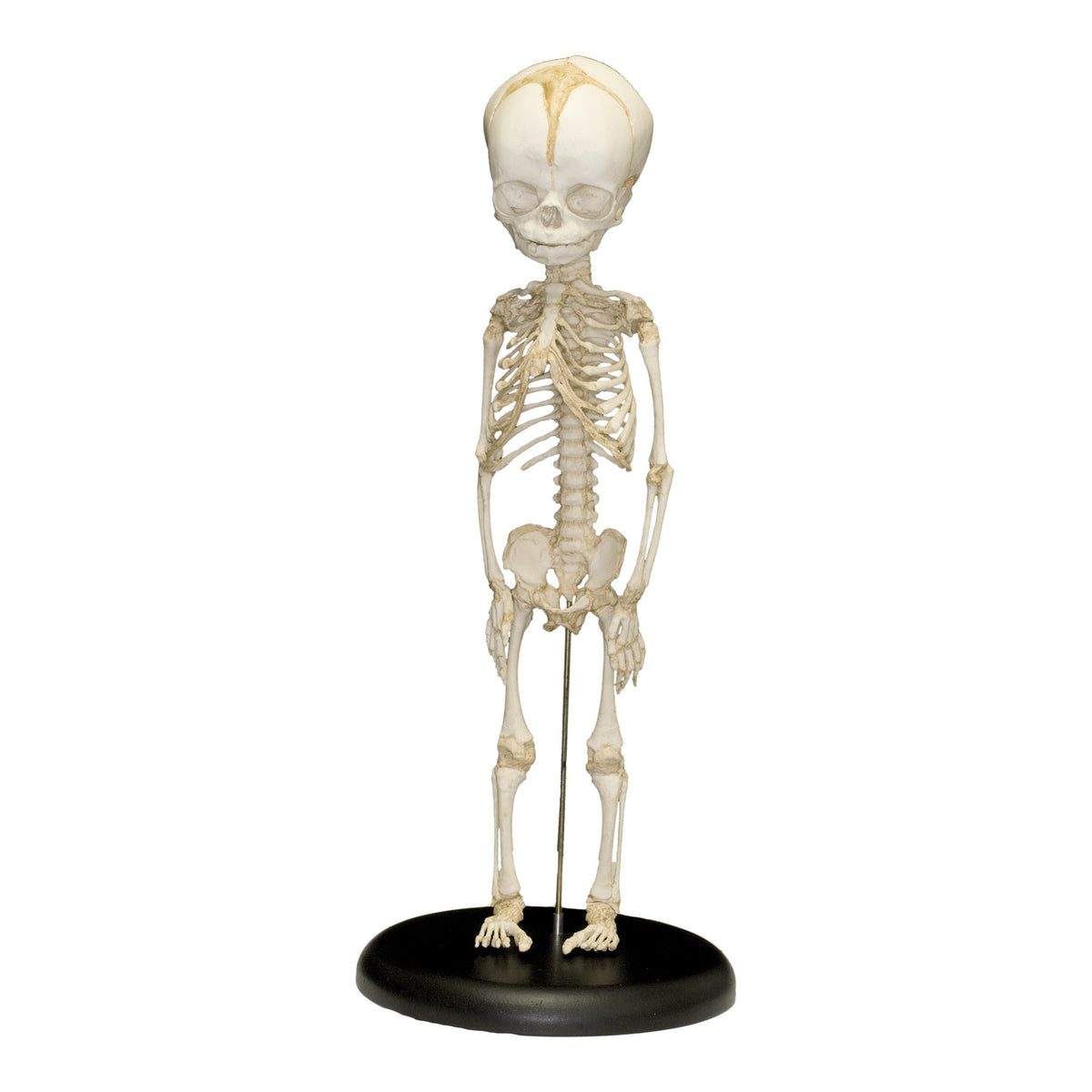 This 32-week-old human fetal skeleton was expertly cast from a
