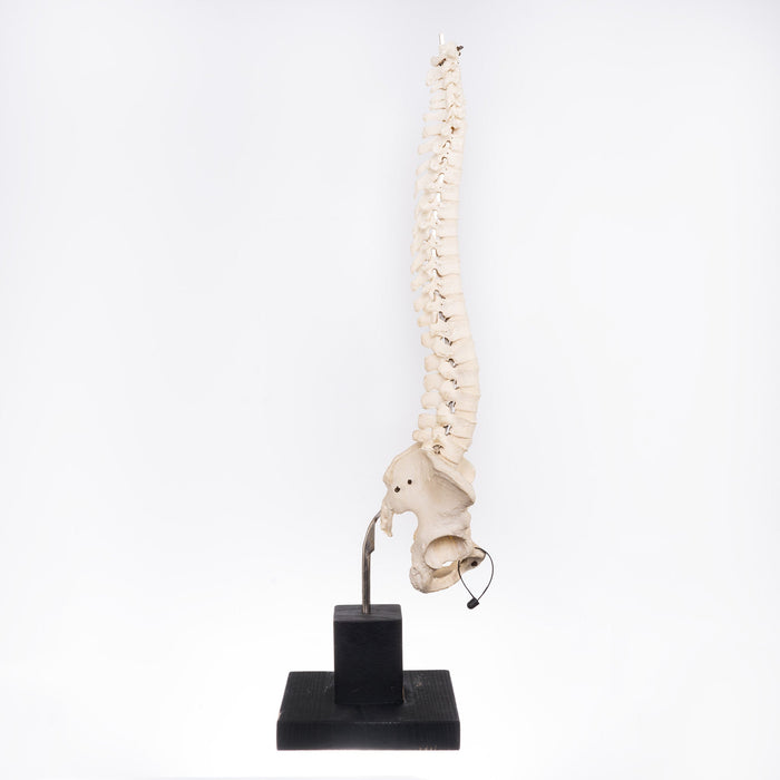 Real Human Spine On Stand