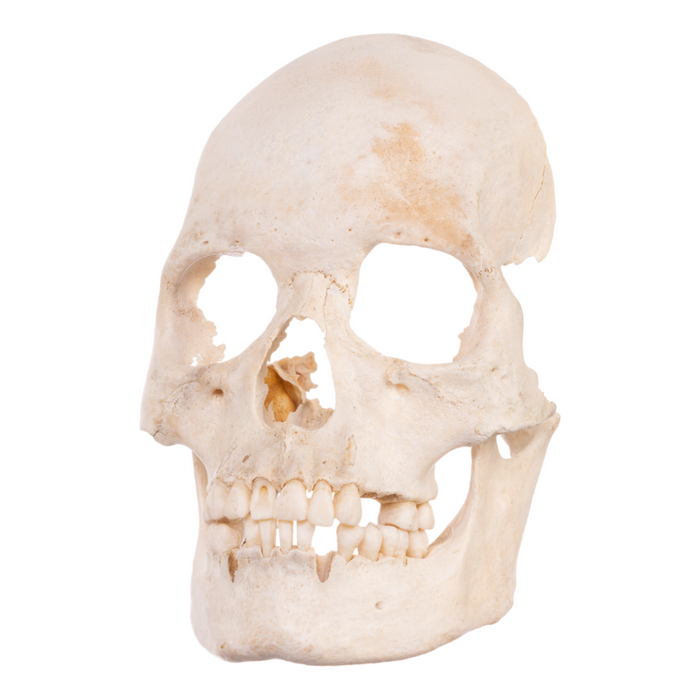 Real Human Skull - Partial