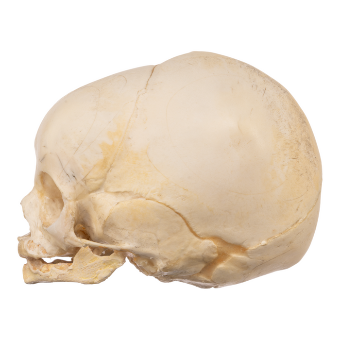 Real Research Quality Human Fetal Skull