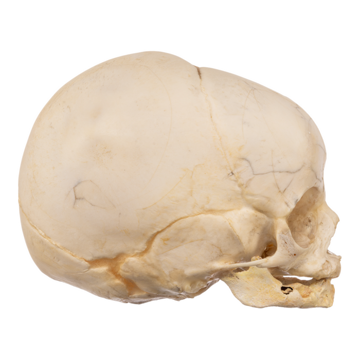 Real Research Quality Human Fetal Skull