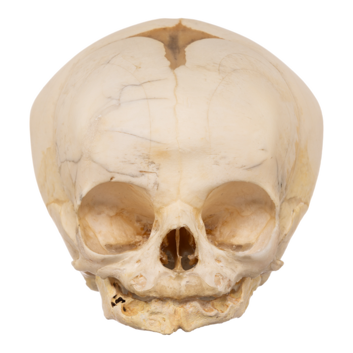 Real Research Quality Human Fetal Skull