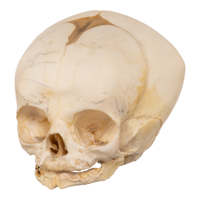 Real Research Quality Human Fetal Skull