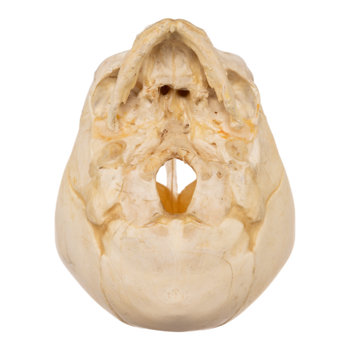 Real Research Quality Human Fetal Skull