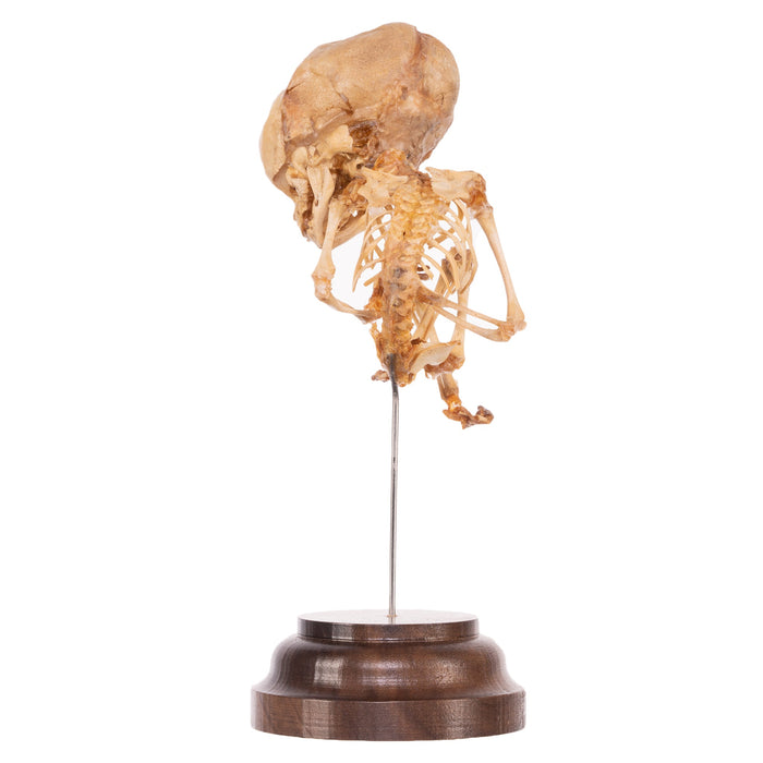 Real Human Fetal Skeleton On Stand