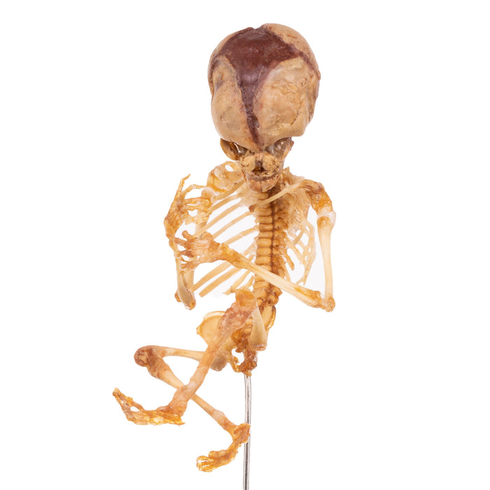 Real Human Fetal Skeleton On Stand