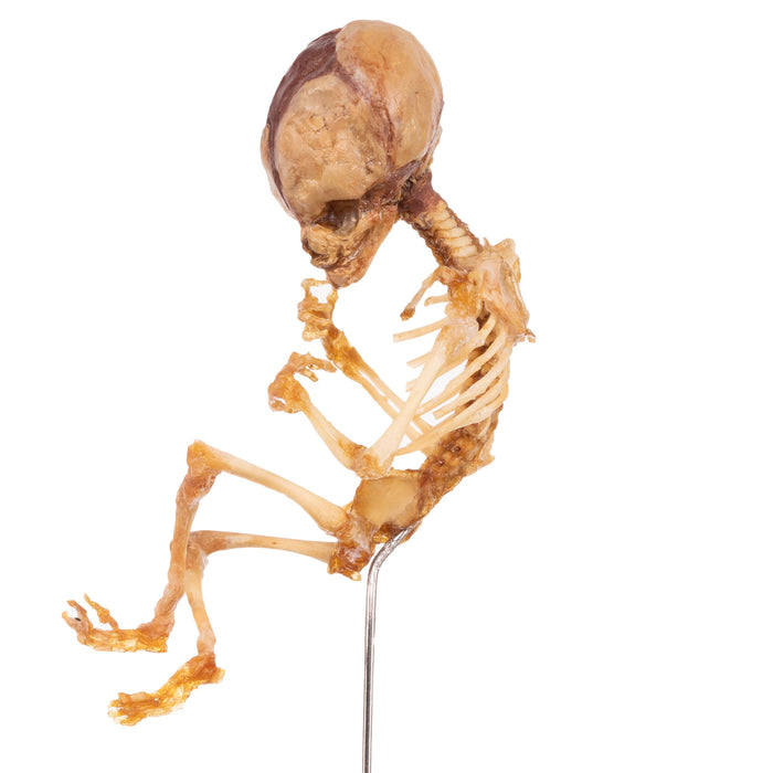 Real Human Fetal Skeleton On Stand