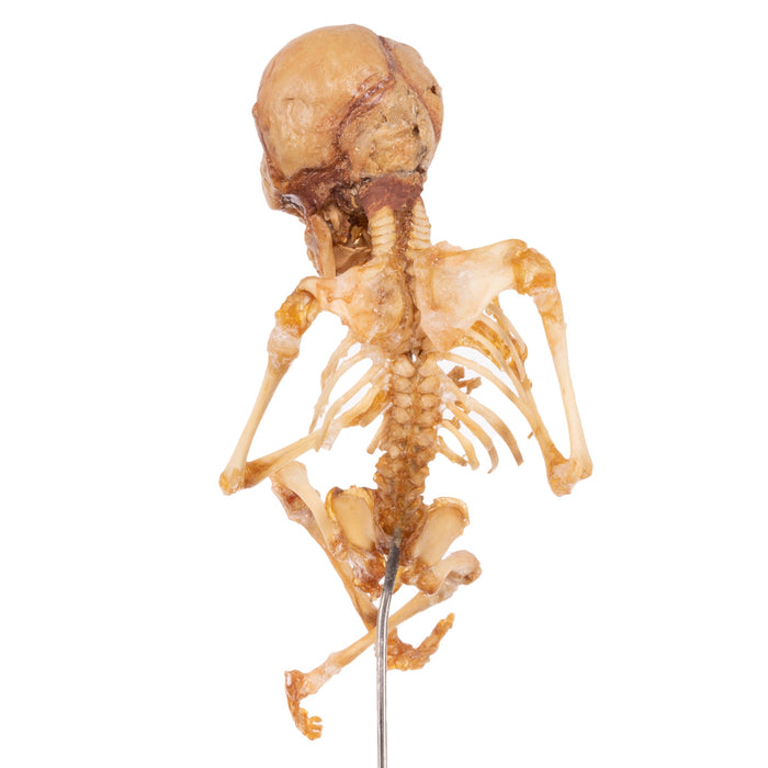 Real Human Fetal Skeleton On Stand