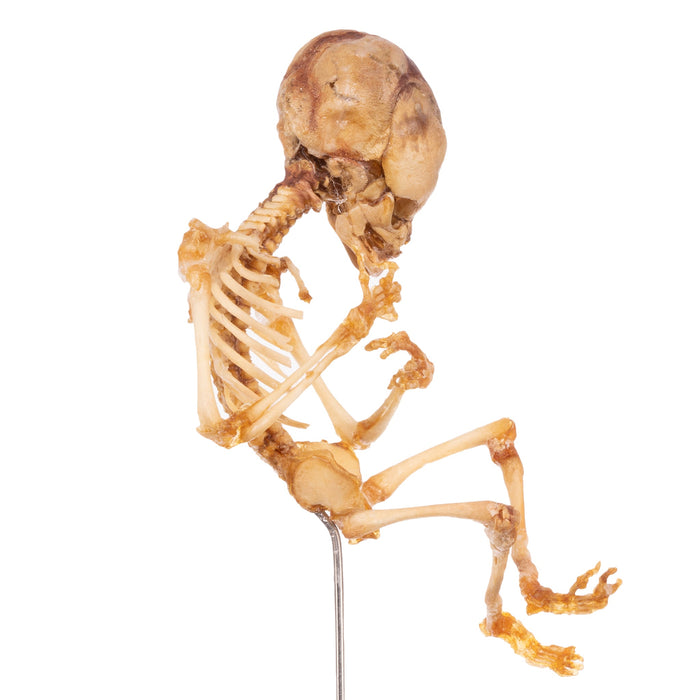 Real Human Fetal Skeleton On Stand