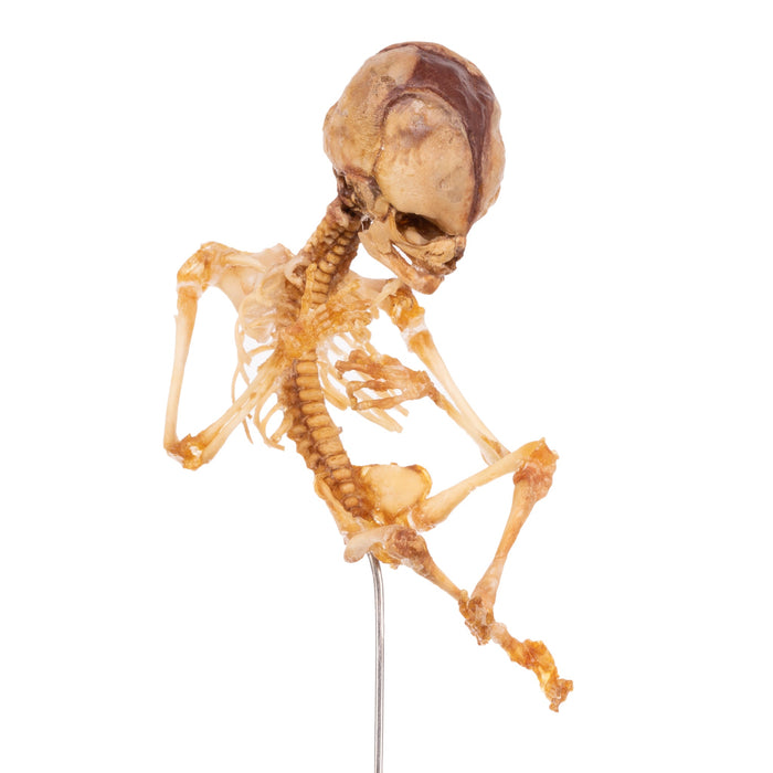 Real Human Fetal Skeleton On Stand