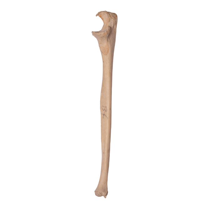 Real Human Ulna - Antique