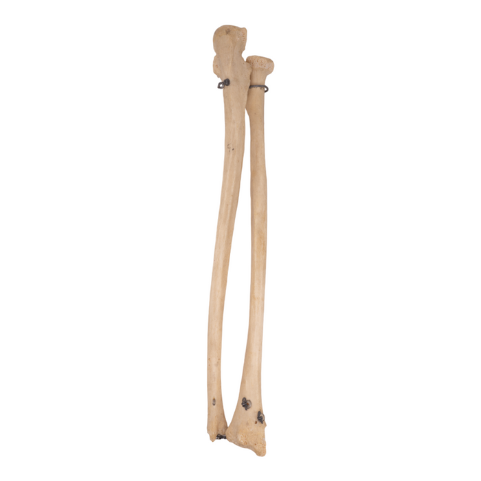 Real Human Ulna and Radius - Antique, Articulated