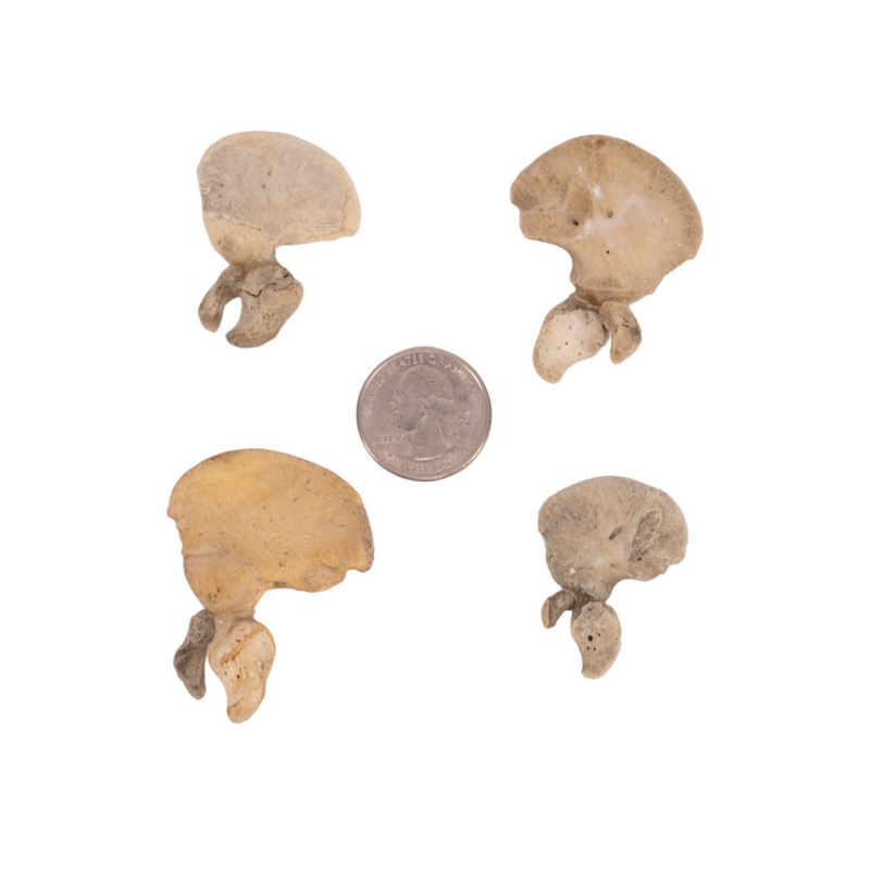 Real Research Quality Human Fetal Ilium - Single