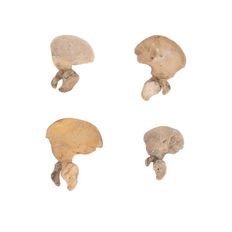 Real Research Quality Human Fetal Ilium - Single