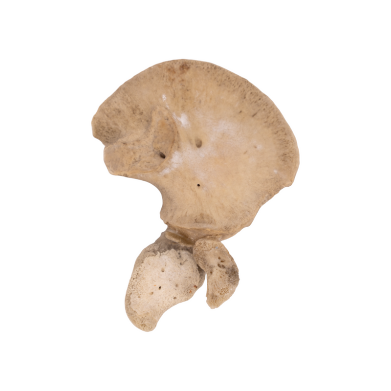 Real Research Quality Human Fetal Ilium - Single