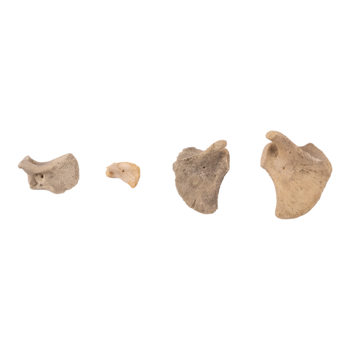 Real Research Quality Human Fetal Scapula - Single