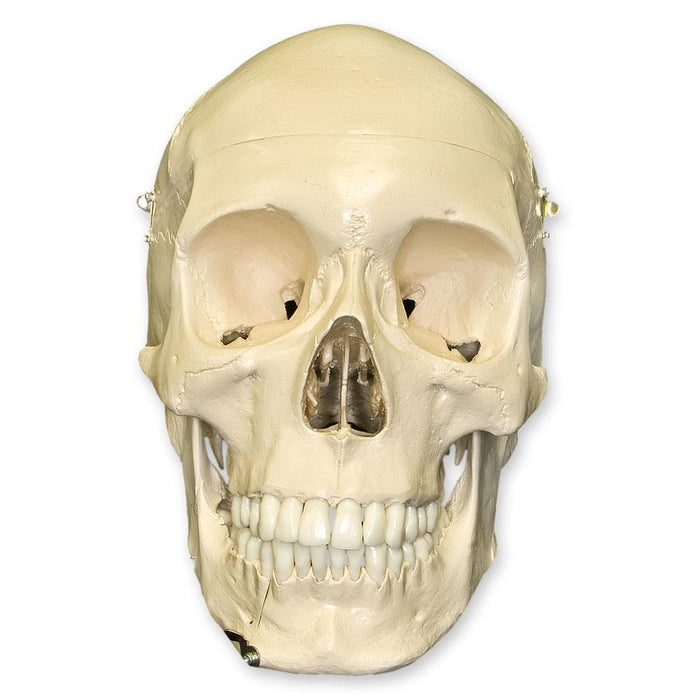 Replica Human Skull with Teeth for Extraction 4 Part