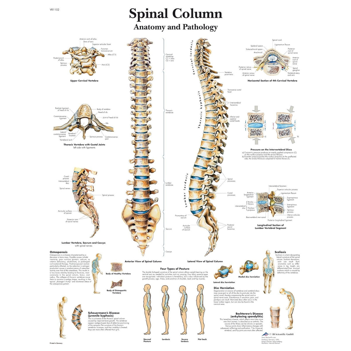 Spinal Column Chart - Laminated For Sale — Skulls Unlimited