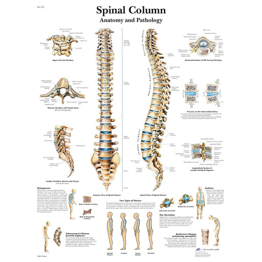 Spinal Column Chart - Laminated For Sale — Skulls Unlimited