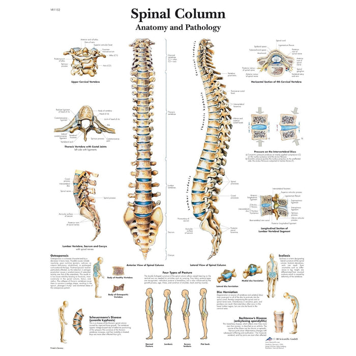 Spinal Column Chart - Laminated
