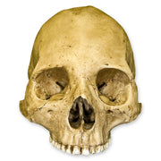 Replica Human Skull - Trephined